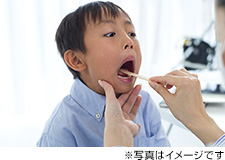 扁桃 腺 が 腫れる 理由